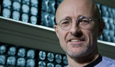 Bác sĩ Italy: ‘Cấy ghép đầu giúp con người tiến gần bất tử’