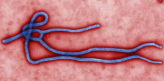 Vì sao virus Ebola nguy hiểm