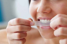 10 bí kíp giúp răng trắng sáng