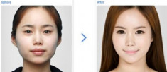 Cải thiện gương mặt và nhân dáng