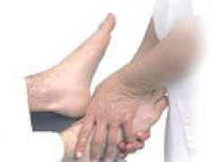 Chăm sóc bàn chân cho bệnh nhân tiểu đường