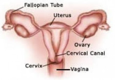 Đau và sưng tấy có thể báo hiệu ung thư buồng trứng