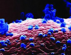 Mỹ cảnh báo về chủng cúm H1N1 mới