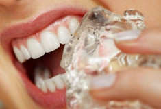 Vì sao răng bạn dễ bị gãy?
