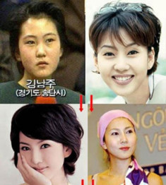 U50 Kim Nam Joo đẹp quên tuổi vì thẩm mỹ