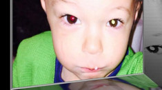 Bố Việt cảnh báo cha mẹ kiểm tra ung thư mắt trẻ bằng iPhone