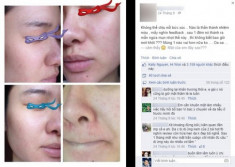 Cô gái Việt “nát mặt” vì mỹ phẩm trôi nổi trên mạng
