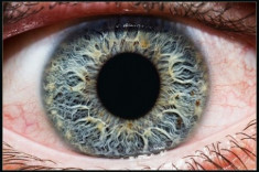 Đây là ý nghĩa của chấm đen trên mống mắt, hãy kiểm tra ngay