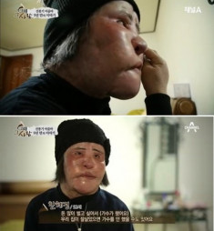  Cuộc sống cô đơn của ‘thảm họa thẩm mỹ’ xứ Hàn 