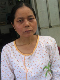  ‘Cô gái hóa bà lão’ được sang Đài Loan điều trị gương mặt 