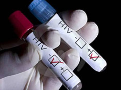  Hiểu đúng về HIV để tránh những nỗi ‘lo hão’ 