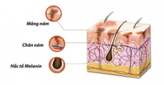 Melanin: kẻ thù của làn da?.