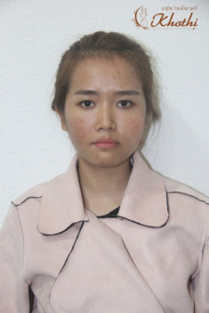 Hành trình “lột xác” thành hot girl của nữ công sở Sài Gòn từng đau khổ vì da mụn, thâm