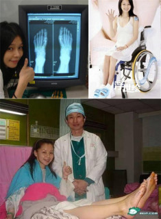 Sao Hoa ngữ người nhập viện, kẻ ngồi xe lăn vì giày cao gót