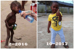 Hình ảnh mới nhất của cậu bé từng bị bỏ đói được giải cứu gây chấn động thế giới