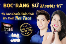 Đắt hơn vàng với 12 triệu/1 răng, nhưng Răng sứ Showbiz HT vẫn có sức hút mãnh liệt