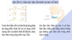 Hết gọt đến độn bằng silicon, giờ đây chị em tìm đến phương pháp “trượt” với chính cằm của mình!