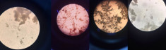 Loạt ảnh “mặt Trăng” được chia sẻ nhiều trên MXH thực chất là... phân dưới kính hiển vi