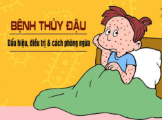 4 sai lầm “nói mãi mẹ không nhớ” khi chữa thủy đậu cho con khiến bé nặng bệnh