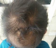 Dự đoán tính cách, vận mệnh tương lai của bé có 4 xoáy tóc cực hiếm