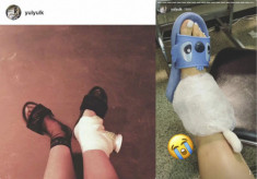 Fan lo lắng vì Yuri (SNSD) chấn thương cổ chân ngay trước ngày trở lại