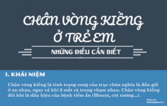 Bác sĩ chỉ cách phát hiện trẻ bị chân vòng kiềng ngay từ nhỏ