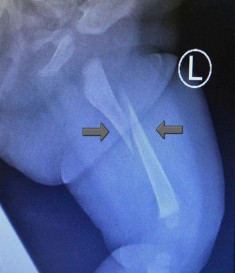 Bé 3 tháng khóc không ngừng khi đi nhà trẻ về, bố sốc nặng khi nghe bác sĩ kết luận