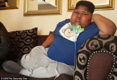 Cuộc sống hàng ngày chỉ ăn và ăn khiến cậu bé 10 tuổi đã có cân nặng quá đáng sợ