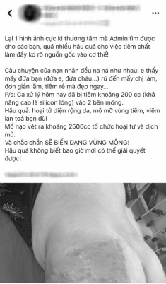 Chuyện cô gái bị hoại tử nặng nề vùng mông do tiêm filler và lời cảnh tỉnh của bác sĩ!