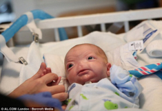 Mỹ: Kỳ lạ em bé sinh ra không có mũi