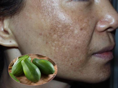 Chán nâng ngực, giờ chị em còn treo ngực, và đây là kết quả của màn treo ngực “định mệnh”