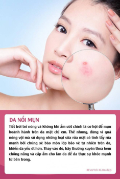 Hè đến mang theo loạt bệnh về da, chị em đừng quên những bí kíp chăm sóc da hiệu quả