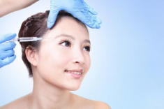 Hết độn cằm, độn ngực giờ đến độn thái dương, hiệu quả chưa biết nhưng hậu quả đã thấy rồi