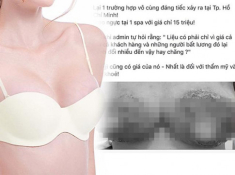 Khi “dao kéo” đổ bộ, ai cũng có thể hoá mỹ nhân, nhưng sau tất cả, có chắc bình yên?