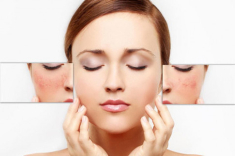 Nhờ bí quyết từ thiên nhiên - thoát kiếp da yếu, tổn thương do làm đẹp sai cách