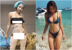 Nổi tiếng với sắc vóc đẹp như mơ, hotgirl Thái Lan gây sốc khi công khai dao kéo toàn thân