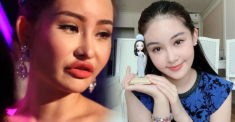 Quên đi thời môi sưng căng phồng, Ngân Anh giờ đây thăng hạng nhan sắc không ngờ