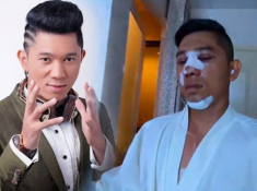 Selfie bên bạn trai với khuôn mặt băng bó chằng chịt, Ngân 98 cũng mới “lên đời” nhan sắc?