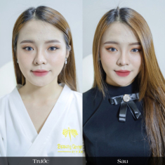 2020 rồi, tạm biệt gương mặt to bè Uline đi vì đã có Vline Perfect