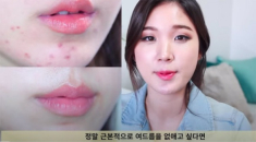 Beauty blogger Hàn chia sẻ nên và không nên ăn gì cho da mụn, nàng lưu ngay vào thực hiện