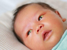 Mắt trẻ sơ sinh bị vàng, nguyên nhân do đâu?