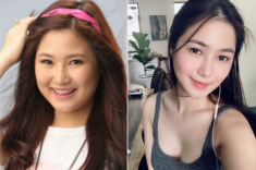 Hương Tràm đẹp lên bội phần nhờ chiếc mũi thanh tú sau phẫu thuật thẩm mỹ