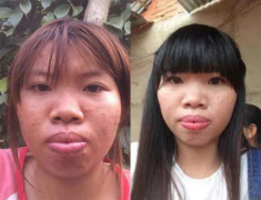Sau nhiều năm dao kéo, Phượng Thị Nở đăng đàn chuyện bị chế giễu bởi quá khứ kém xinh