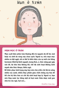 6 vị trí mụn mọc thường gặp trên gương mặt nói gì về tình trạng cơ thể bạn?