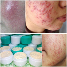 Bo Shop khuyên bạn nên dùng mỹ phẩm chính hãng, tránh xa kem trộn