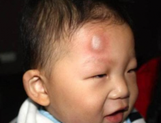 Bé 1 tuổi ngã trên giường xuống, thái độ của mẹ làm bà nội khó chịu, bác sĩ lại khen
