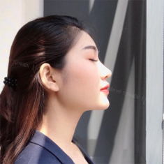 Nâng mũi tại Natural: Sửa một lần, đẹp một đời