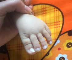 Ảnh ngón chân dài như tay của con mới sinh gây sốc, người mẹ cuối cùng thú nhận sự thật