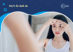 Bối rối vì mụn ẩn – Học ngay cách xử lý hiệu quả từ “chuyên gia” Biodermato