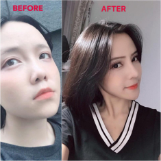 Phẫu thuật nâng mũi ảnh hưởng đến cả tài vận: chuyên gia thẩm mỹ nói gì?